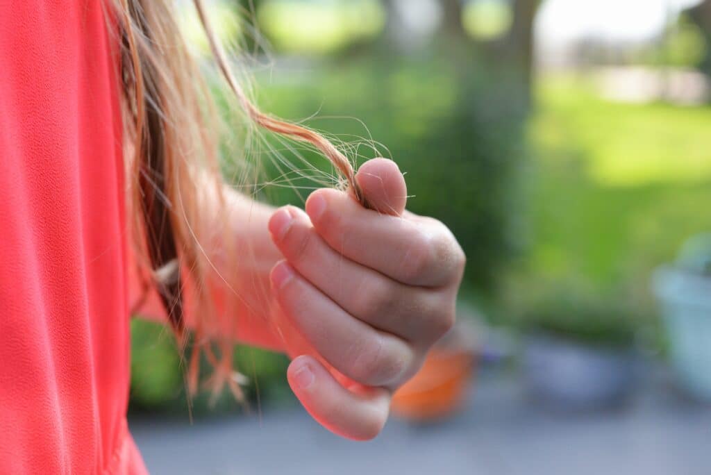 נשירת שיער יכולה לנבוע מפגמים בצורת ובגודל של זקיקי השיער.