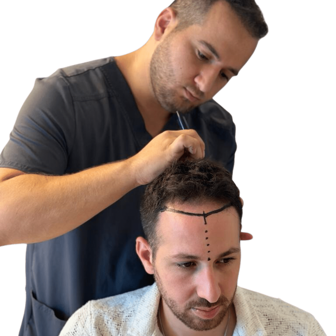 מומחה להשתלת שיער לגברים המתאר את הקרקפת של לקוח גבר להליך השתלת שיער